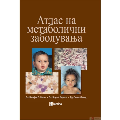 Атлас на метаболични заболувања Медицина Kiwi.mk